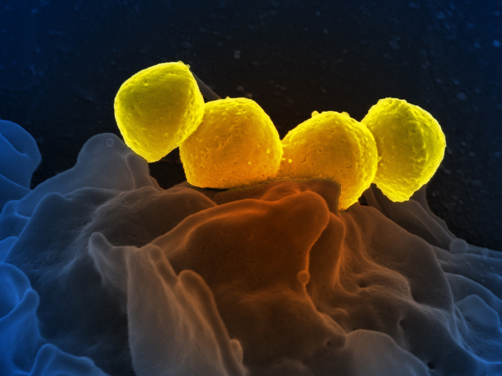A colourized scanning electron micrograph of Group A streptococcus bacteria, in yellow, on human neutrophil, in blue.