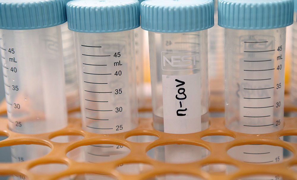 960px version of COVIDVilesLab.jpg