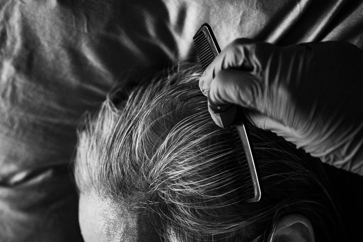 A close up of an elderly woman’s hair, with a hand wearing a medical glove running a comb through it.