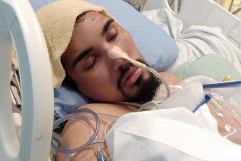 A Man Assaulted at Strathcona Park Lost His Leg
