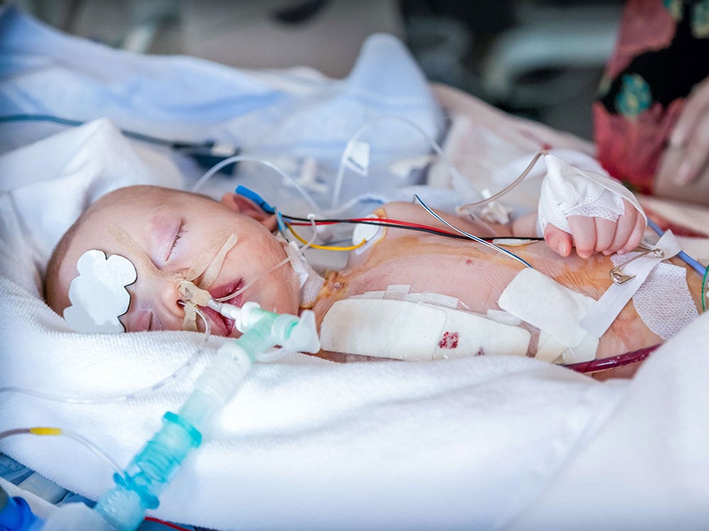 An infant is shown in an intensive care unit, connected to tubes and monitors.