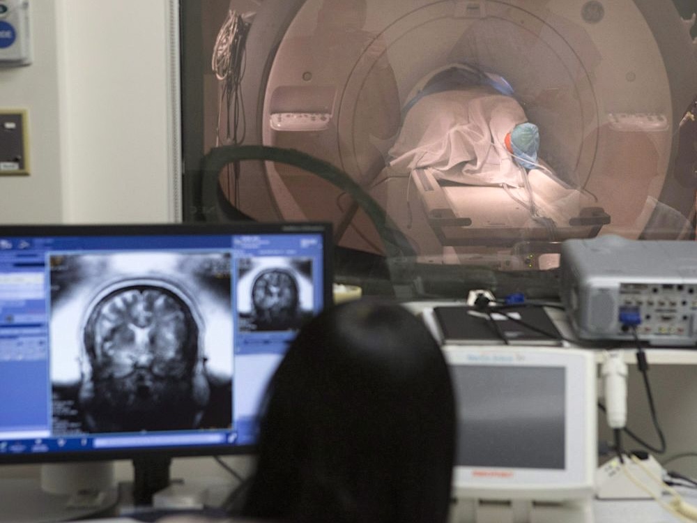 A patient inside an MRI machine as the patient&rsquo;s brain is displayed on a computer monitor that a technician is looking at.