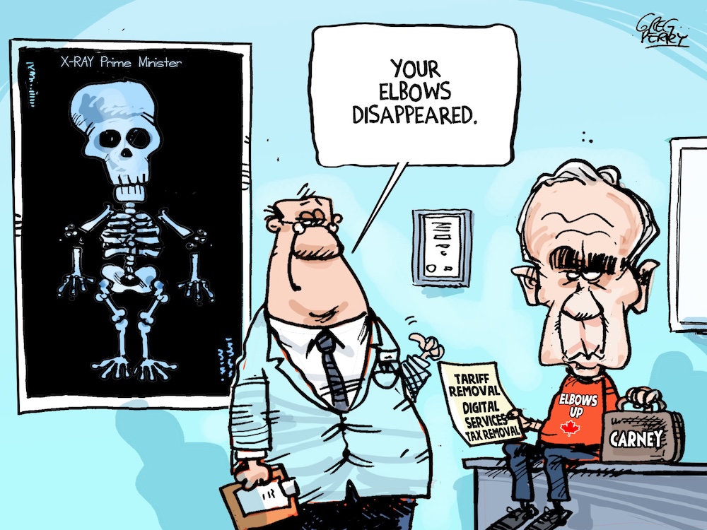 A cartoon shows Mark Carney, in a doctor&rsquo;s office, with the doctor saying &lsquo;Your elbows disappeared.&rsquo;
